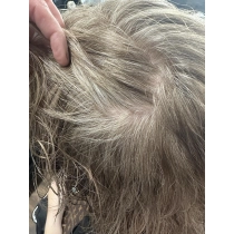 Lightest Blonde 10N